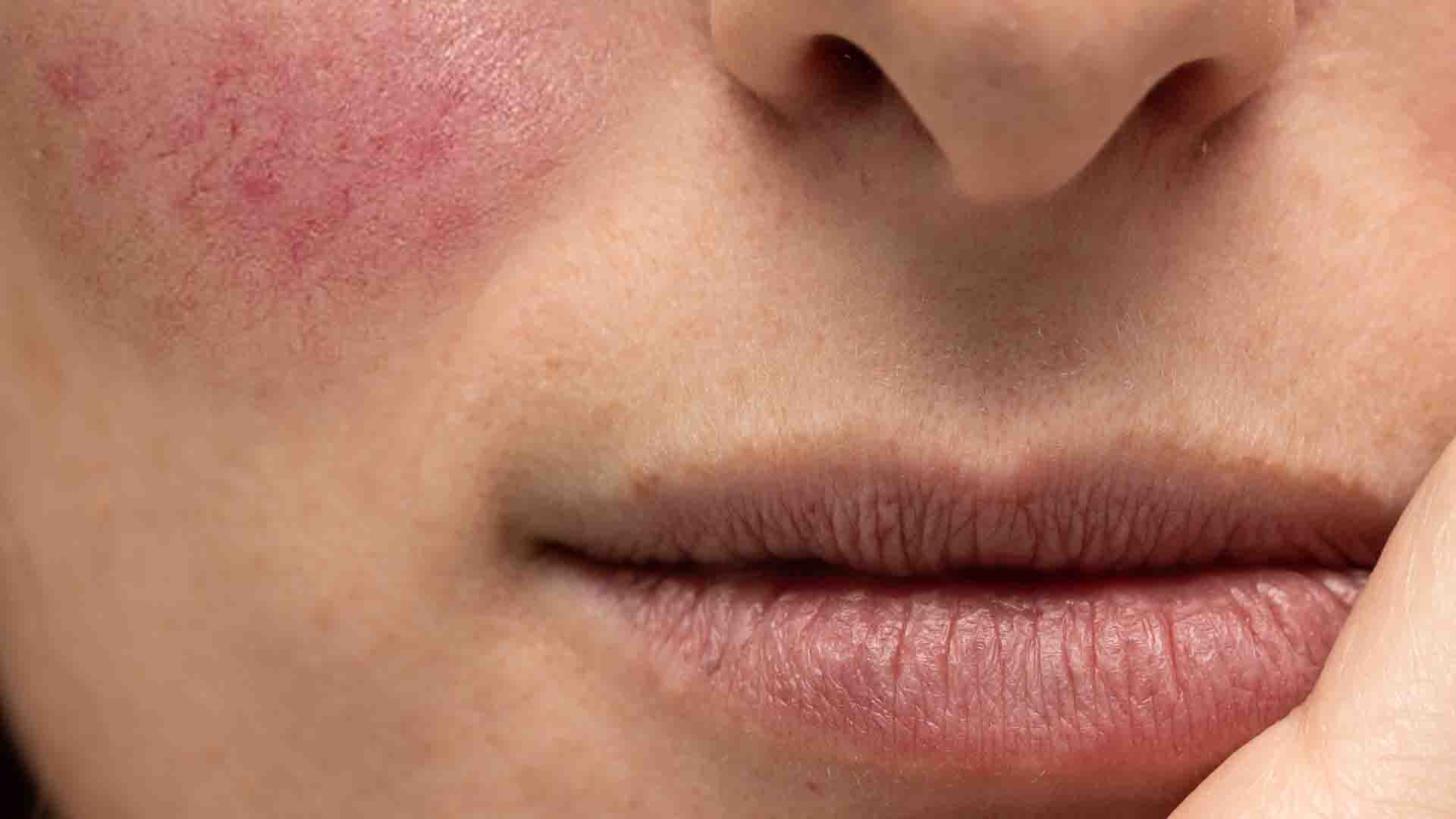 Comment trouver un rendezvous avec un dermatologue
